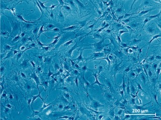 Mikroskopaufnahme gesunder Knorpelzellen. 